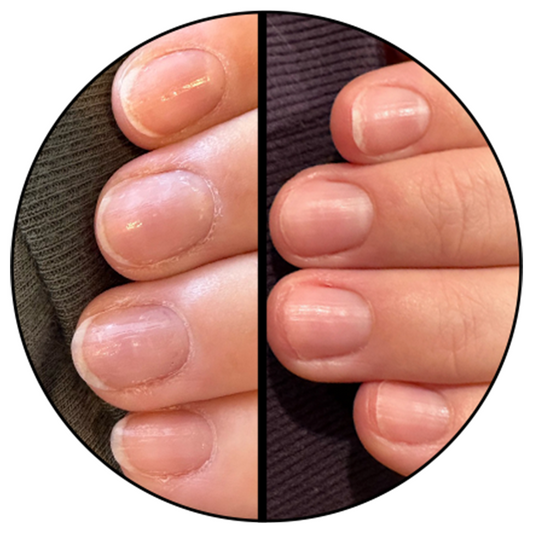Comparison of nails before and after using Cuticle Oil showing improved hydration and smoother cuticles for nail care.