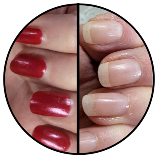 before and after showing painted nails before and shiny clean nails after